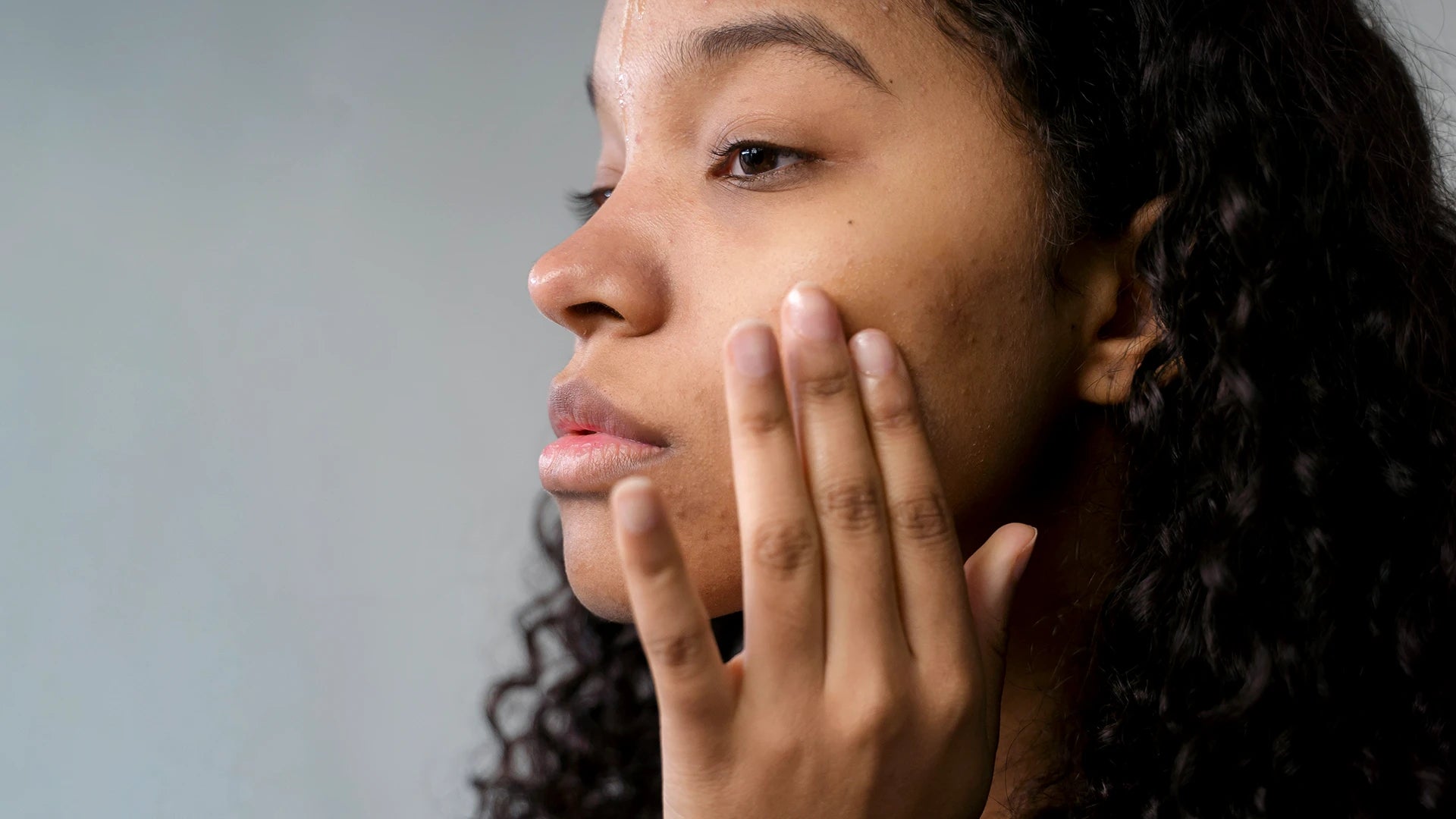 Woman with acne touching her face